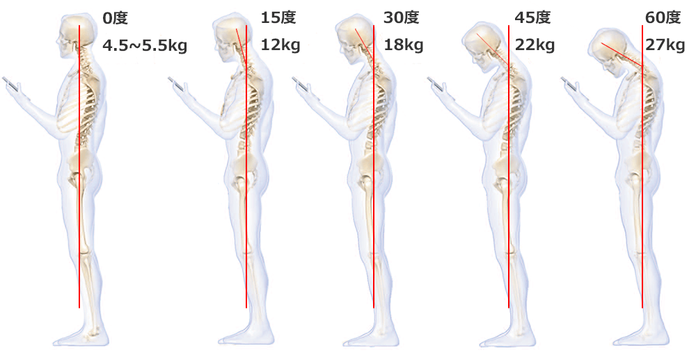 首の角度と負担