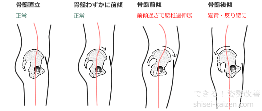 骨盤の傾き