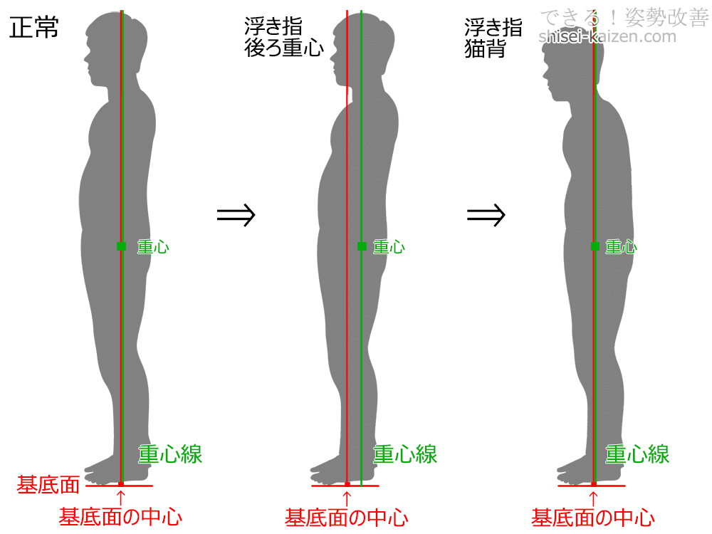 浮き指から猫背に